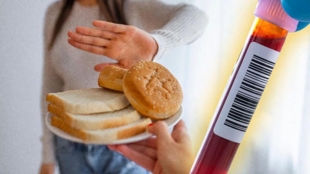 Anti Gliadin IgA Nedir?